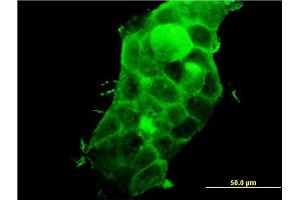Immunofluorescence of monoclonal antibody to PDLIM5 on A-431 cell. (PDLIM5 antibody  (AA 1-596))