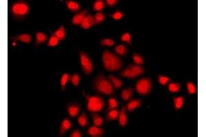 Immunofluorescence analysis of A549 cells using MLF1 Polyclonal Antibody (MLF1 antibody)
