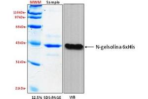 Western Blotting (WB) image for Gelsolin (GSN) (AA 1-403), (N-Term) protein (His tag) (ABIN5675807)