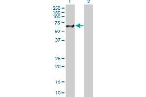 Western Blot analysis of USP14 expression in transfected 293T cell line by USP14 MaxPab polyclonal antibody. (USP14 antibody  (AA 1-494))