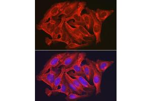 Immunofluorescence analysis of U2OS cells using D Rabbit pAb (ABIN6134076, ABIN6139403, ABIN6139404 and ABIN6224222) at dilution of 1:250 (40x lens).