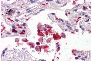 Human Lung (formalin-fixed, paraffin-embedded) stained with AIF1 antibody ABIN337364 at 5 ug/ml followed by biotinylated anti-goat IgG secondary antibody ABIN481715, alkaline phosphatase-streptavidin and chromogen. (Iba1 antibody  (AA 149-161))