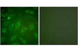 Immunofluorescence analysis of NIH-3T3 cells, using Collagen I Antibody. (Collagen Type I antibody  (AA 1-50))