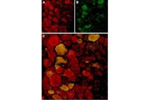Expression of TRPV4 in rat DRGImmunohistochemical staining of rat dorsal root ganglion (DRG) frozen sections using Anti-TRPV4 Antibody (ABIN7043850, ABIN7043994 and ABIN7043995).