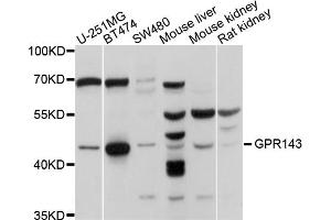 Western blot analysis of extracts of various cell lines, using GPR143 antibody (ABIN5997830) at 1/1000 dilution. (GPR143 antibody)