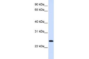 WB Suggested Anti-ORC6L Antibody Titration: 0. (ORC6 antibody  (C-Term))