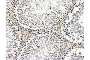 ABIN7096614 and ABIN7100678 at 1/100 staining rat testis tissue by IHC-P. (MON1A antibody)