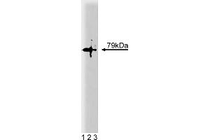 Western Blotting (WB) image for anti-Protein Kinase C, theta (PRKCQ) (AA 21-217) antibody (ABIN967739) (PKC theta antibody  (AA 21-217))