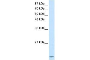 WB Suggested Anti-TARBP2 Antibody Titration:  2. (TARBP2 antibody  (N-Term))