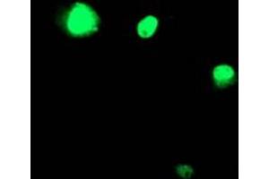 Image no. 3 for anti-T-Cell Acute Lymphocytic Leukemia 1 (TAL1) antibody (ABIN1501292) (TAL1 antibody)