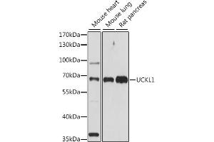 Western blot analysis of extracts of various cell lines, using UCKL1 antibody (ABIN7271233) at 1:1000 dilution. (UCKL1 antibody  (AA 1-200))