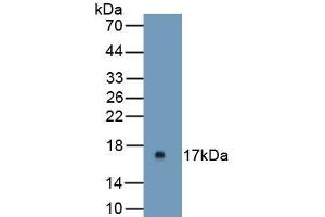 Detection of Recombinant UPK1A, Mouse using Polyclonal Antibody to Uroplakin 1A (UPK1A) (UPK1A antibody  (AA 116-231))
