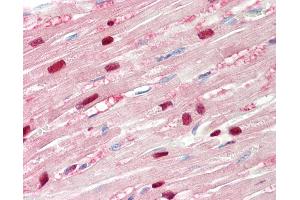 Human, Heart: Formalin-Fixed Paraffin-Embedded (FFPE). (TPI1 antibody  (N-Term))