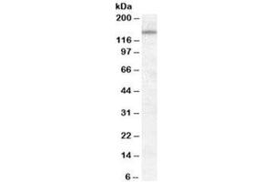 Western blot testing of KELLY cell lysate with DLG1 antibody at 0. (DLG1 antibody)