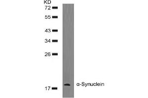 Image no. 2 for anti-Synuclein, alpha (SNCA) (AA 131-135) antibody (ABIN401571) (SNCA antibody  (AA 131-135))