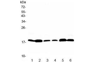 Western blot testing of rat 1) brain, 2) heart, 3) kidney and moouse 4) brain, 5) heart, 6) kidney with MED9 antibody at 0. (MED9 antibody)