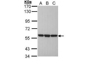 WB Image Sample (30 ug of whole cell lysate) A: H1299 B: Hela C: Hep G2 , 7. (PDIA3 antibody  (C-Term))