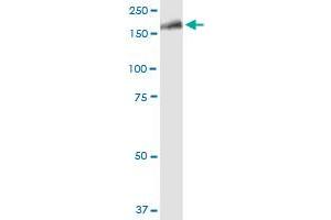 LRRK1 MaxPab polyclonal antibody. (LRRK1 antibody  (AA 1-261))