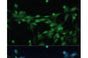 Immunofluorescence analysis of NIH-3T3 cells using CSNK2B Polyclonal Antibody at dilution of 1:100 (40x lens). (CSNK2B antibody)