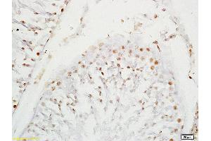 Formalin-fixed and paraffin embedded rat testis labeled with Anti-SOX9/SRA1 Polyclonal Antibody, Unconjugated (ABIN754963) at 1:200 followed by conjugation to the secondary antibody and DAB staining (SOX9 antibody  (AA 121-220))