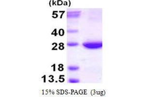 Image no. 1 for RAB31, Member RAS Oncogene Family (RAB31) protein (His tag) (ABIN1098265)