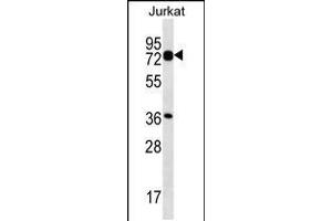 Western blot analysis in Jurkat cell line lysates (35ug/lane). (PLS1 antibody  (C-Term))