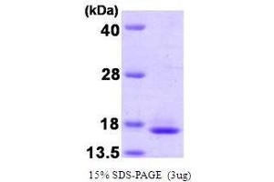 Figure annotation denotes ug of protein loaded and % gel used. (TCEB2 Protein (AA 1-118))