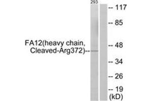 Western blot analysis of extracts from 293 cells, treated with etoposide 25uM 1h, using FA12 (heavy chain,Cleaved-Arg372) Antibody.