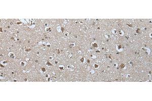 Immunohistochemistry of paraffin-embedded Human brain tissue using USP35 Polyclonal Antibody at dilution of 1:55(x200) (USP35 antibody)