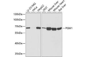 Western blot analysis of extracts of various cell lines, using PGM1 antibody  at 1:1000 dilution. (Phosphoglucomutase 1 antibody  (AA 1-300))