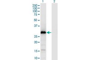 Western Blot analysis of GAGE1 expression in transfected 293T cell line by GAGE1 monoclonal antibody (M04), clone 4G6. (G Antigen 1 antibody  (AA 1-139))
