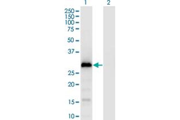G Antigen 1 Antikörper  (AA 1-139)