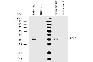 Western blotting analysis of human CD28 using mouse monoclonal antibody CD28. (CD28 antibody)