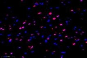 Immunofluorescent analysis of paraformaldehyde-fixed rat hippocampus using MED3 (ABIN7074581) at dilution of 1: 1000 (MED27 antibody)