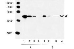 Multiple Tag Cell Lysate (ABIN1536505) Primary antibody: A. (Myc Tag antibody)