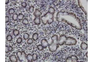 Immunohistochemistry (Formalin-fixed Paraffin-embedded Sections) (IHC (fp)) image for anti-Myocyte Enhancer Factor 2A (MEF2A) (AA 71-170) antibody (ABIN561778)