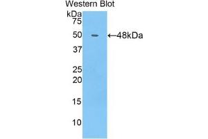 Detection of Recombinant COL14, Human using Polyclonal Antibody to Collagen Type XIV (COL14) (COL14A1 antibody  (AA 1280-1461))