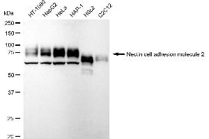 Western blotting analysis using LPP antibody (ABIN7799277).