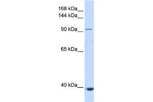 WB Suggested Anti-IFIH1 Antibody Titration:  0. (IFIH1 antibody  (Middle Region))