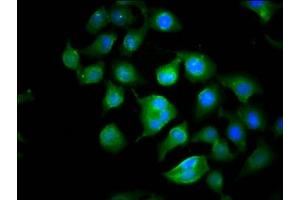 Immunofluorescence staining of A549 cells with ABIN7149328 at 1:100, counter-stained with DAPI. (CYFIP1 antibody  (AA 320-449))