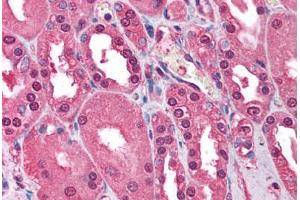 Human Kidney (formalin-fixed, paraffin-embedded) stained with ATM antibody ABIN213900 at 1-2 ug/ml followed by biotinylated goat anti-rabbit IgG secondary antibody ABIN481713, alkaline phosphatase-streptavidin and chromogen. (ATM antibody  (C-Term))