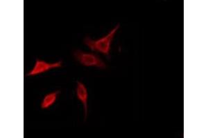 ABIN6278556 staining HeLa by IF/ICC. (CARD10 antibody  (N-Term))