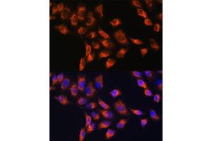 Immunofluorescence (IF) image for anti-Serpin Peptidase Inhibitor, Clade G (C1 Inhibitor), Member 1 (SERPING1) (AA 201-500) antibody (ABIN3022430)