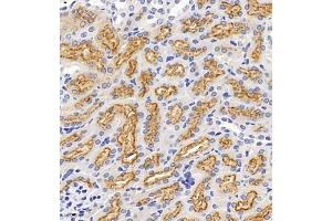 Immunohistochemistry of paraffin embedded mouse kidney using Megalin (ABIN7074514) at dilution of 1:1000 (400x lens) (LRP2 antibody)