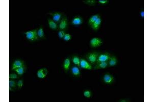 Immunofluorescence staining of HepG2 cells with ABIN7172220 at 1:100, counter-stained with DAPI. (Titin antibody  (AA 5398-5604))