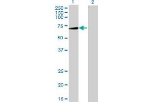 Western Blotting (WB) image for ALPPL2 293T Cell Transient Overexpression Lysate(Denatured) (ABIN1330891)