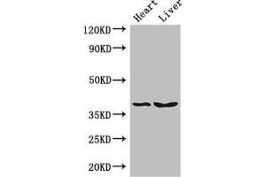 Western Blot Positive WB detected in: Mouse heart tissue, Mouse liver tissue All lanes: CTSB antibody at 3 μg/mL Secondary Goat polyclonal to rabbit IgG at 1/50000 dilution Predicted band size: 38 kDa Observed band size: 38 kDa