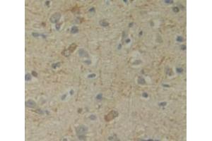 IHC-P analysis of Human Tissue, with DAB staining. (Uracil Phosphoribosyltransferase (UPP) (AA 75-297) antibody)