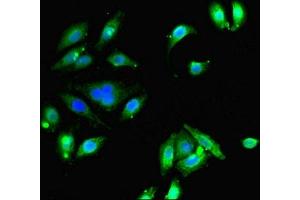 Immunofluorescent analysis of A549 cells using ABIN7152056 at dilution of 1:100 and Alexa Fluor 488-congugated AffiniPure Goat Anti-Rabbit IgG(H+L) (Ethanolamine Kinase 1 antibody  (AA 90-258))