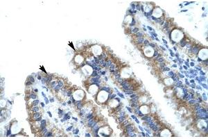 Immunohistochemical staining (Formalin-fixed paraffin-embedded sections) of human intestine with MECOM polyclonal antibody . (MECOM antibody  (AA 964-1013))